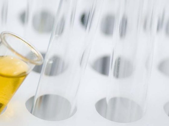 urin_heaad
