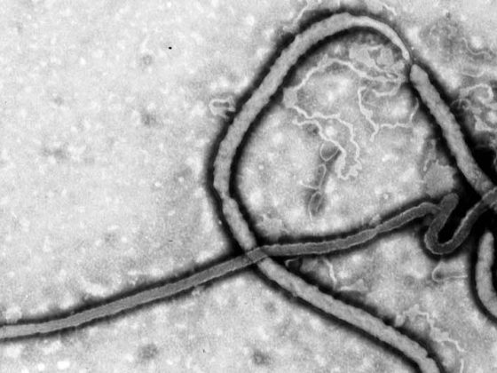 head_ebola
