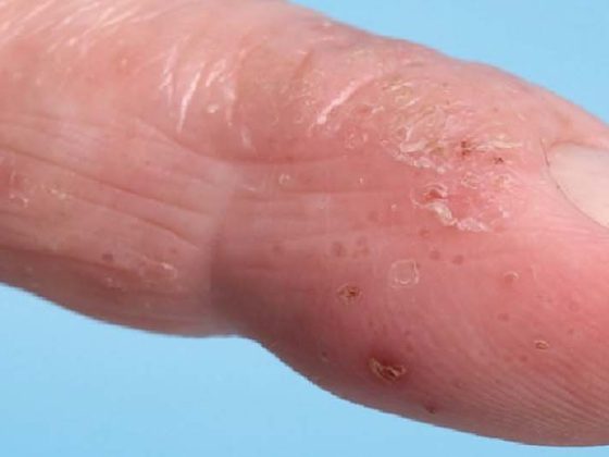 finger