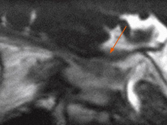 header_neuroimages