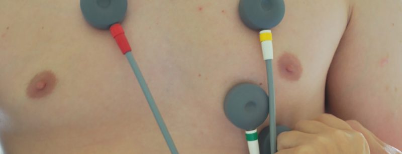 ekg_herz2