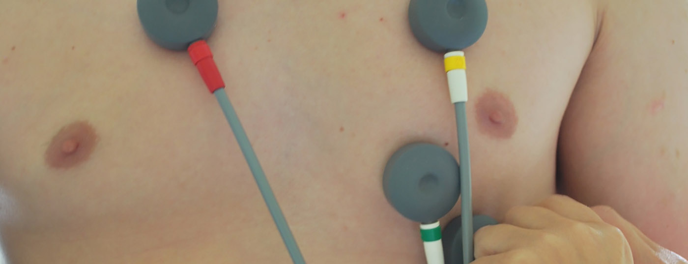 ekg_herz2