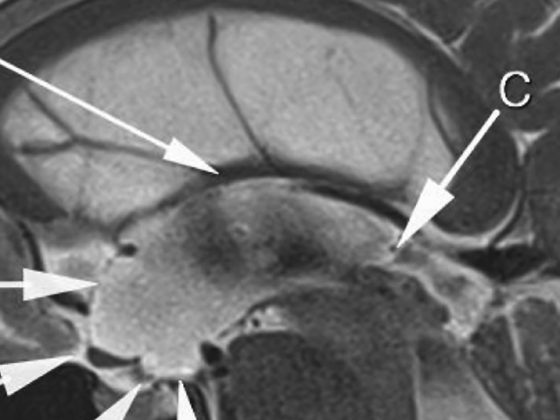 header_neuroimages_np3