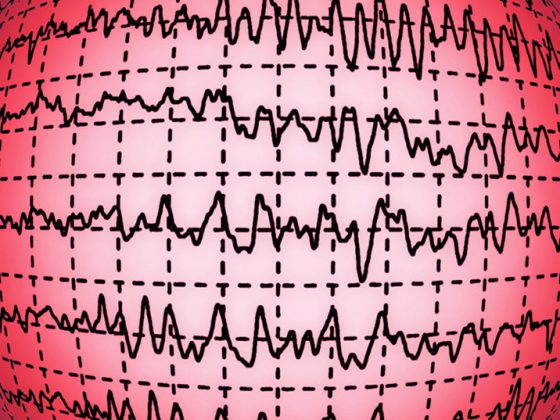 eeg_hirnwellen