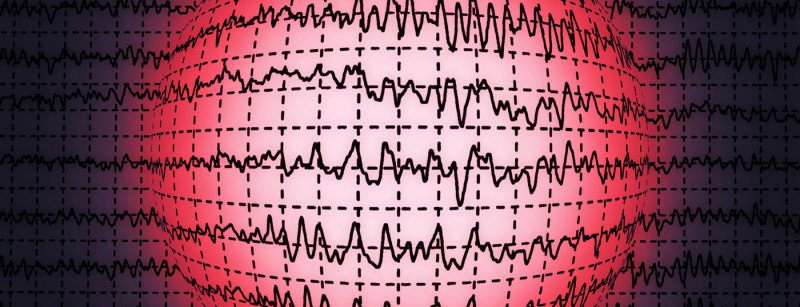 eeg_hirnwellen