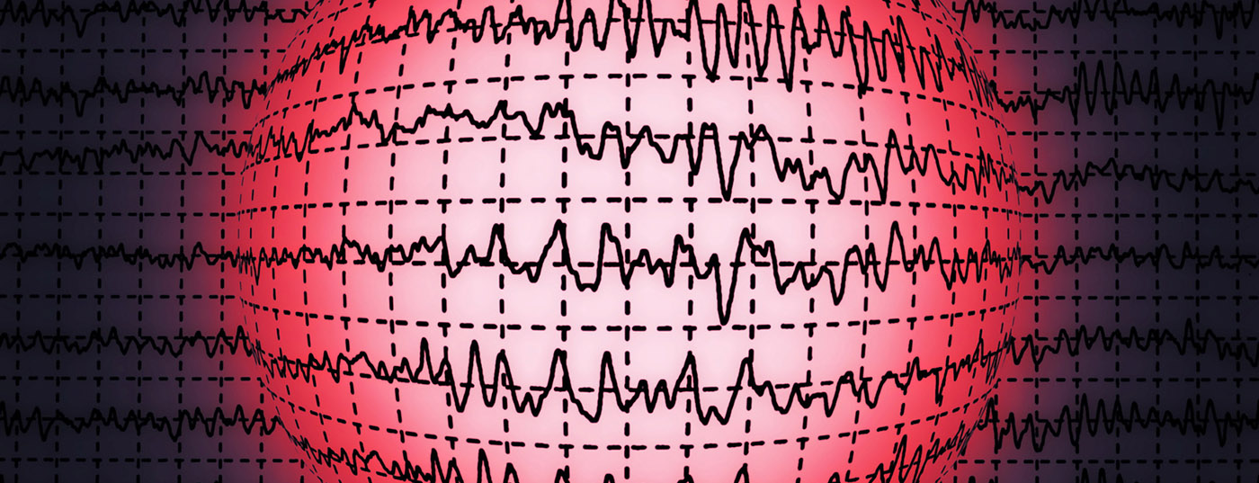eeg_hirnwellen