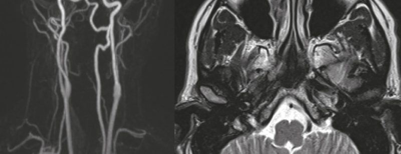 header_neuroimages_np5-15