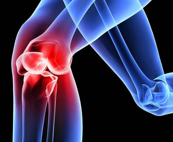 knie_head