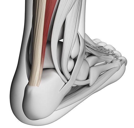 achilles_head