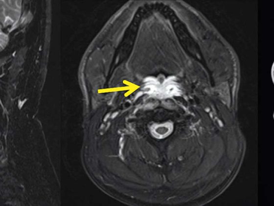 neuroimages_np1