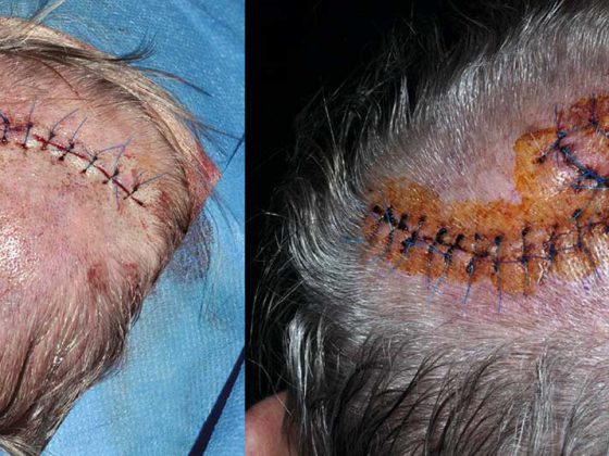 header_dermatochirurgie