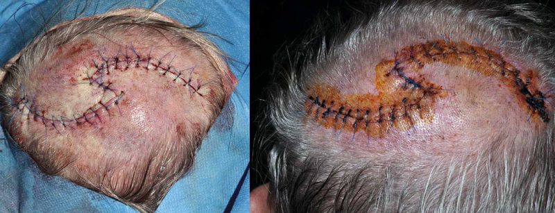 header_dermatochirurgie