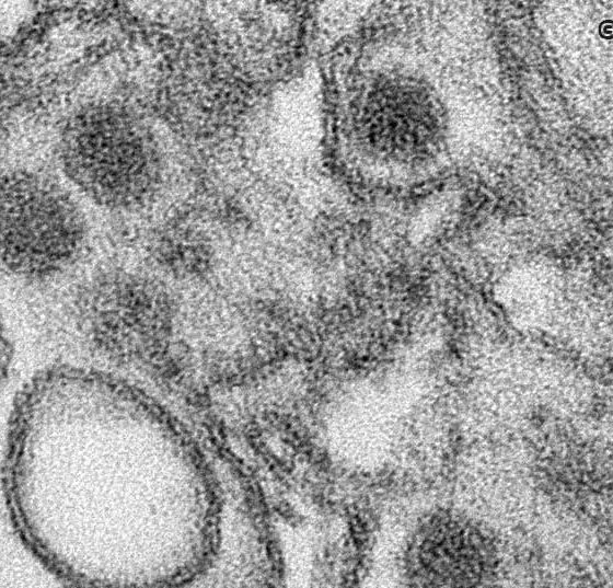 zika