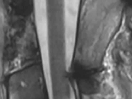 header_neuroimages_np3
