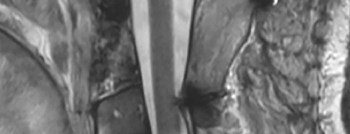 header_neuroimages_np3