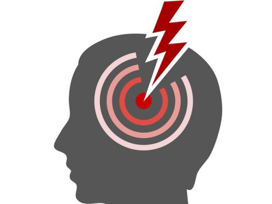 fotolia_85334598_s