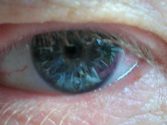 auge