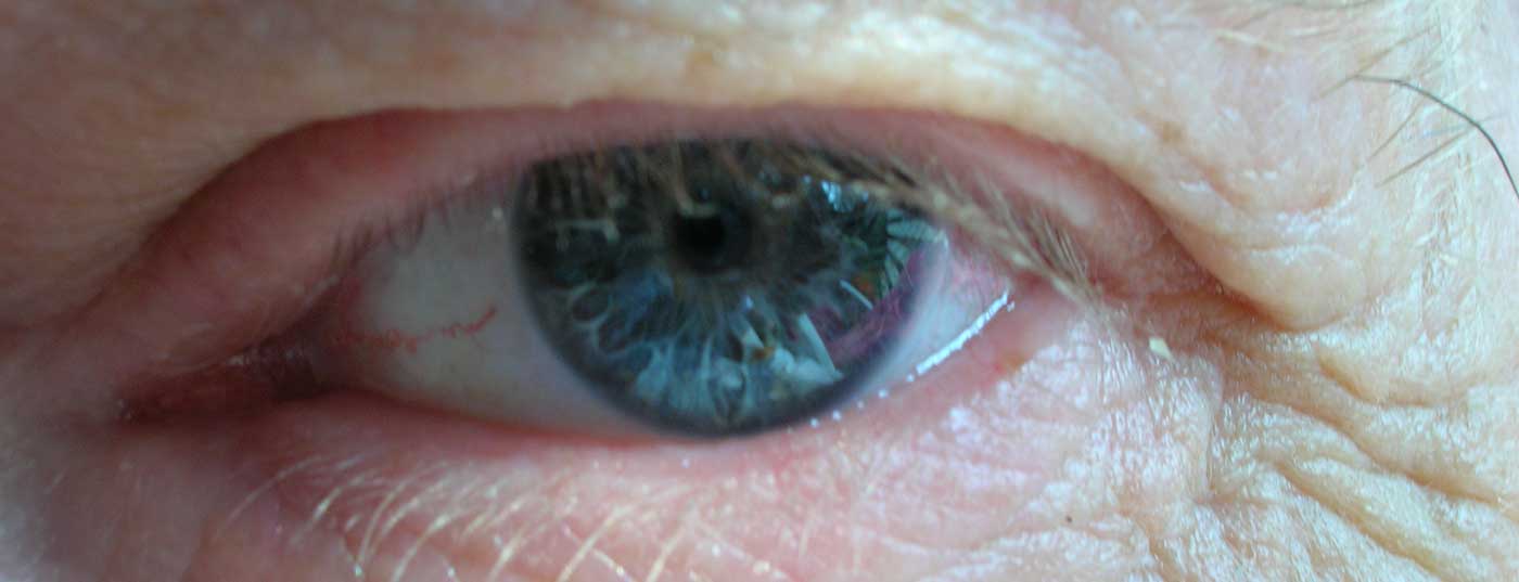 auge