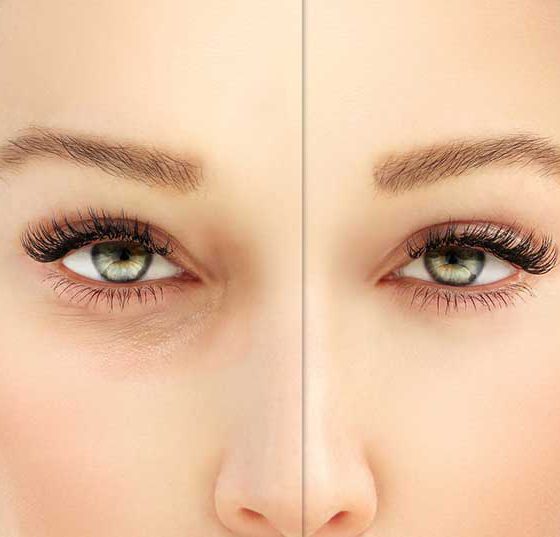 augen_lid