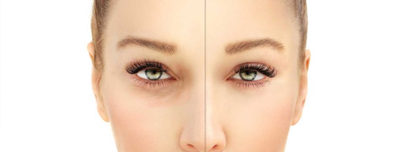 augen_lid