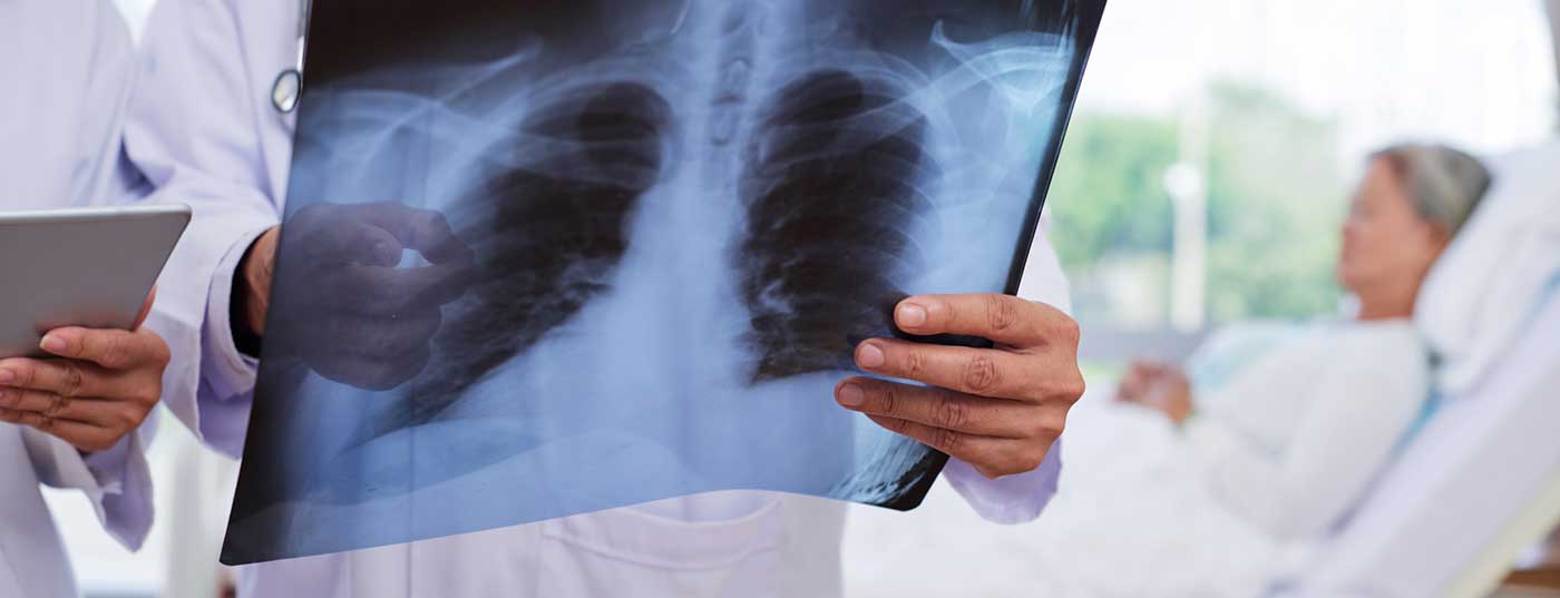lunge2