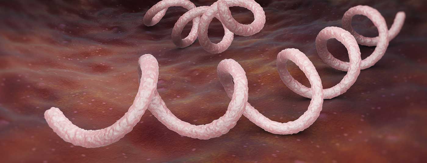 syphilis