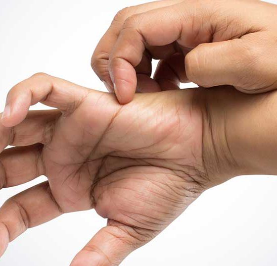 hand_kratzen_jucken