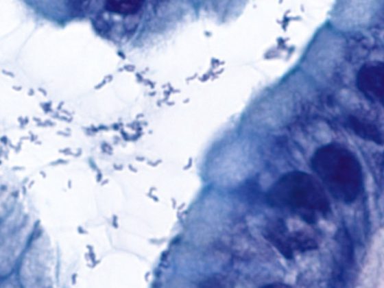helicobacter2