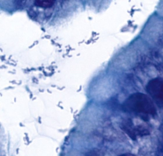 helicobacter2