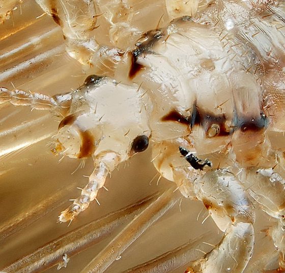 kopflaus