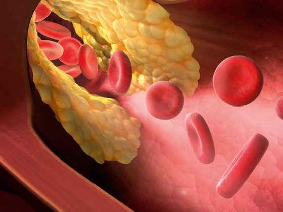 arterie_blut