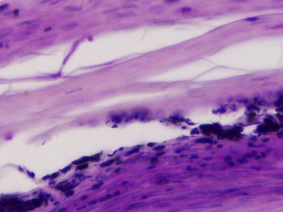 nagelhistologie