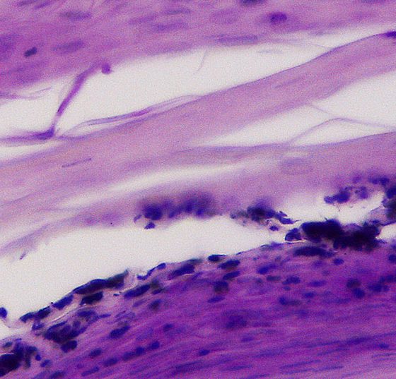 nagelhistologie