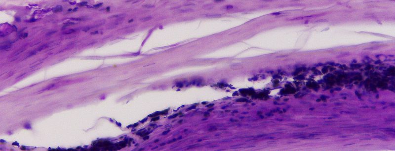 nagelhistologie