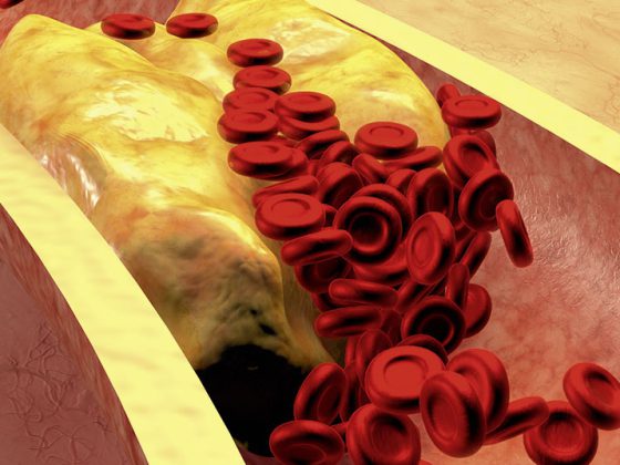 blut3