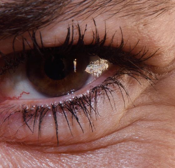 auge_frau_istock-658371830
