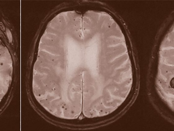 header_stroke