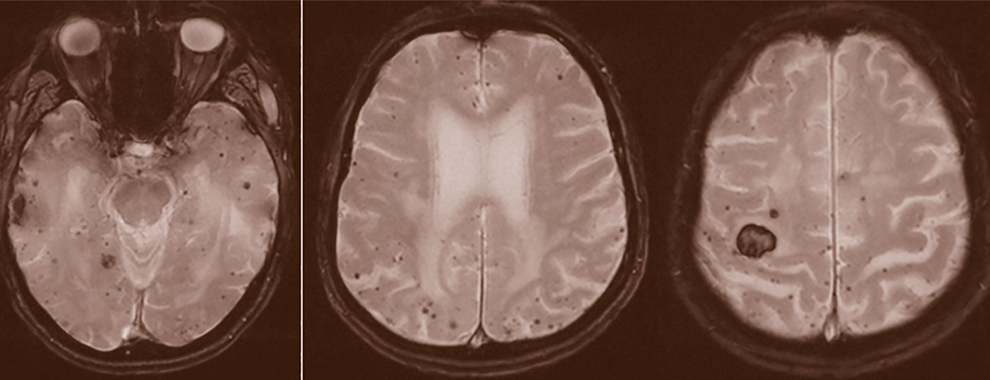 header_stroke