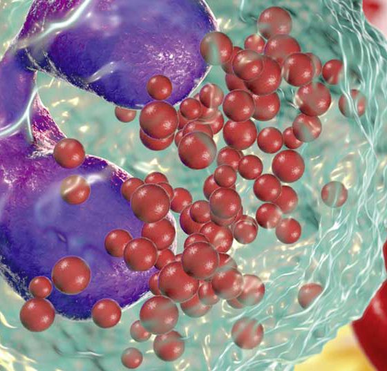 eosinophilen_istock-1010726344