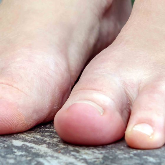 istock-483324562_2
