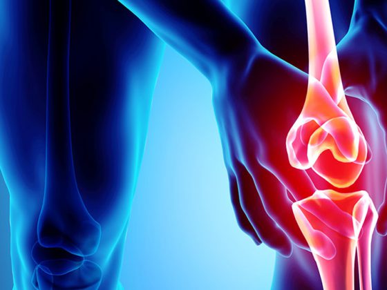 arthrose-knie_istock-956015576