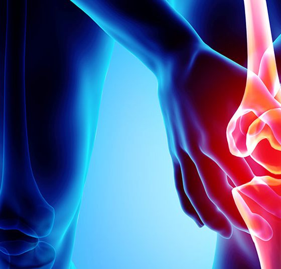 arthrose-knie_istock-956015576