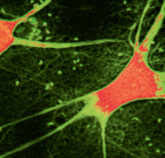 neuronen_istock-1165714317