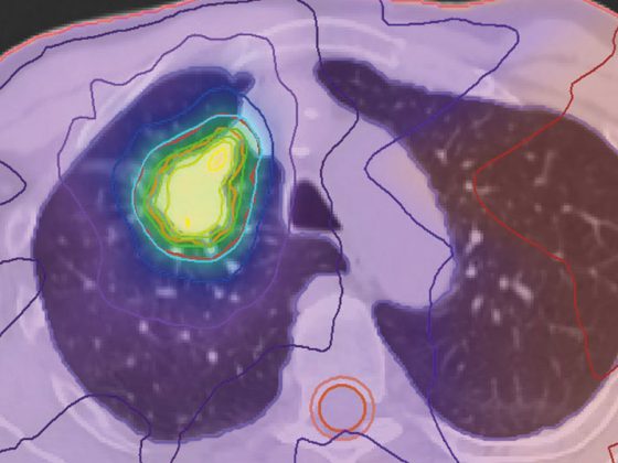 headerdietzel