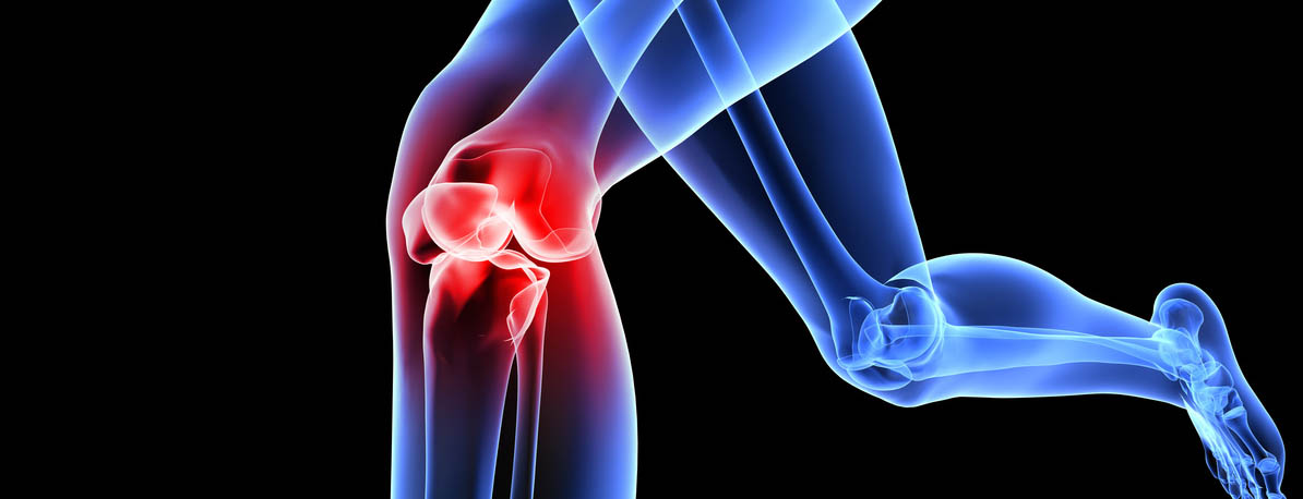 knie_head