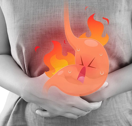 reflux_istock-896837100