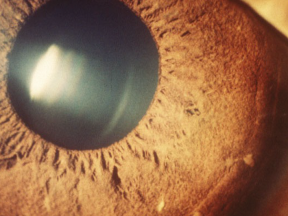 header_barthelmes