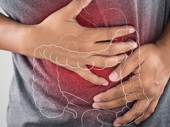 istock-962782170-2