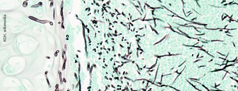 aspergillose_wikimedia
