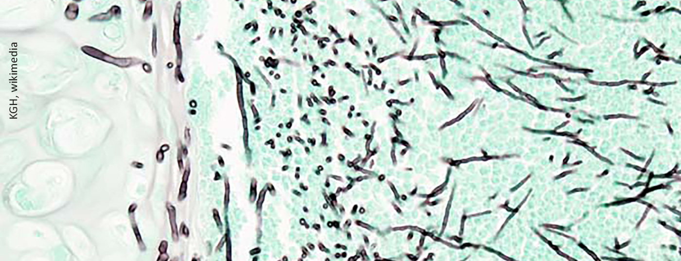 aspergillose_wikimedia